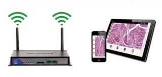 60FPS WiFiの移動の顕微鏡のデジタル カメラ表示4グループのクロスヘアの